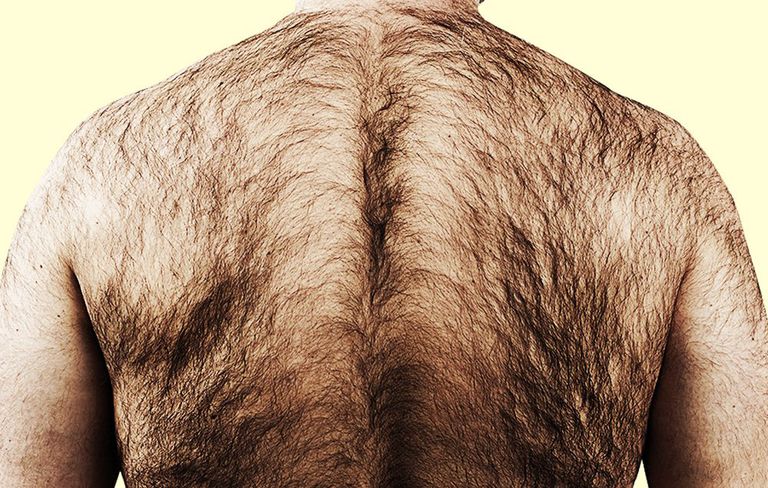 Men's Journal: How to Get Rid of Back Hair | Shobha